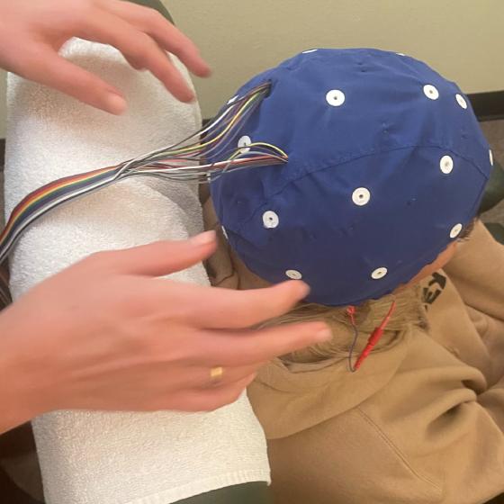 QEEG brain mapping service at Healthy Within, San Diego